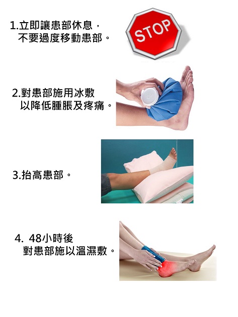 扭傷之處置？ 的圖片