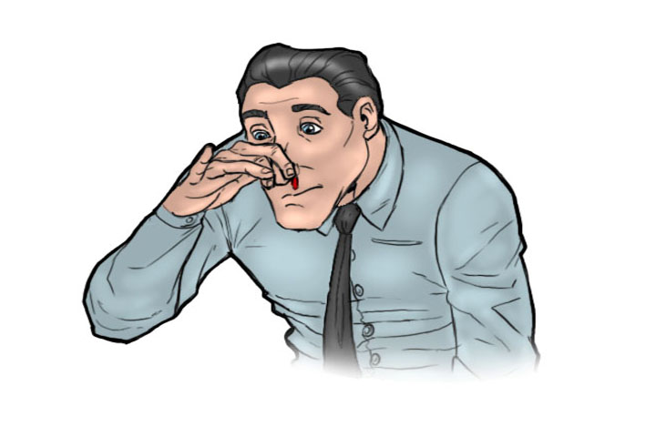 鼻出血處置？ 的第1張圖片